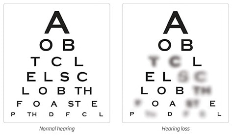 Normal and hearing loss comparrison