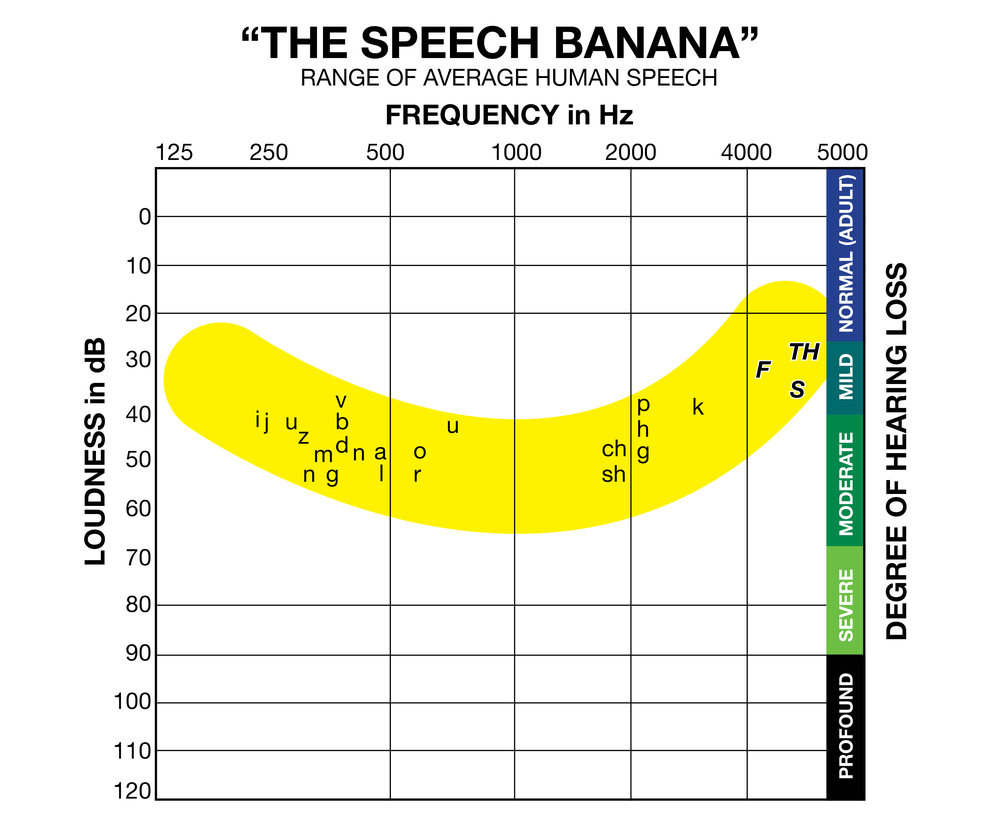 The Speech Banana Audiogram Illustration